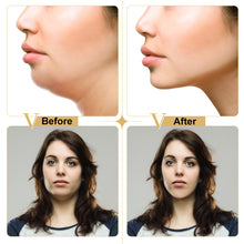 Load image into Gallery viewer, Miracle V Shape Slimming Mask Facial Line Remover  Double Chin Reducer - thesaleconnect22
